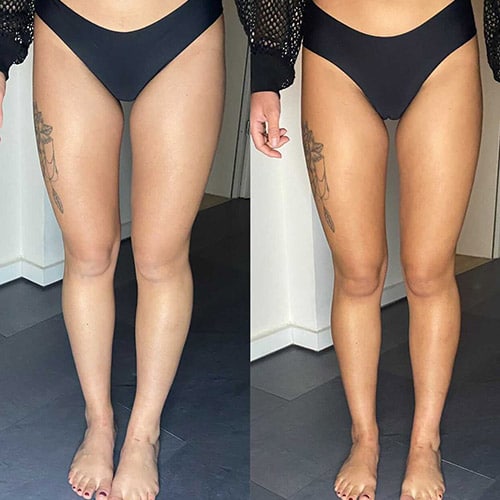 Zelfbruiner before & after venice body. Selftan mousse vegan.