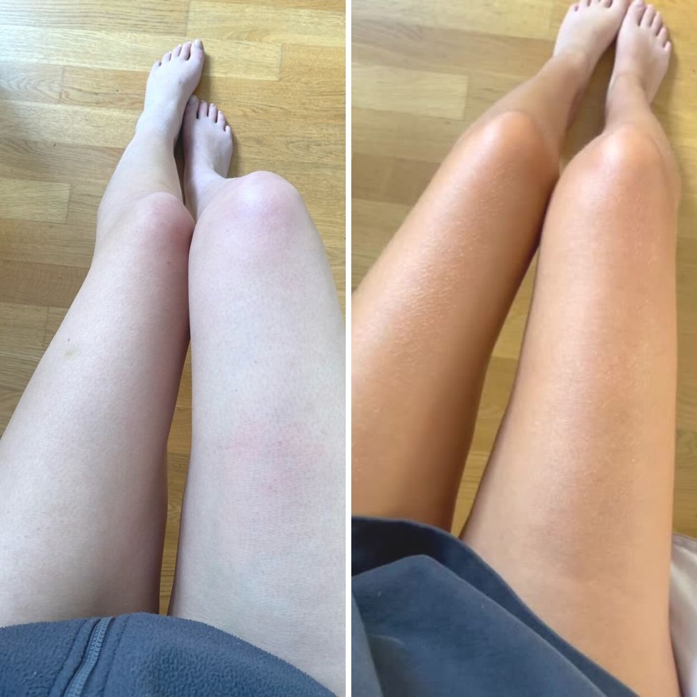 before & after zelfbruiner vegan venice body